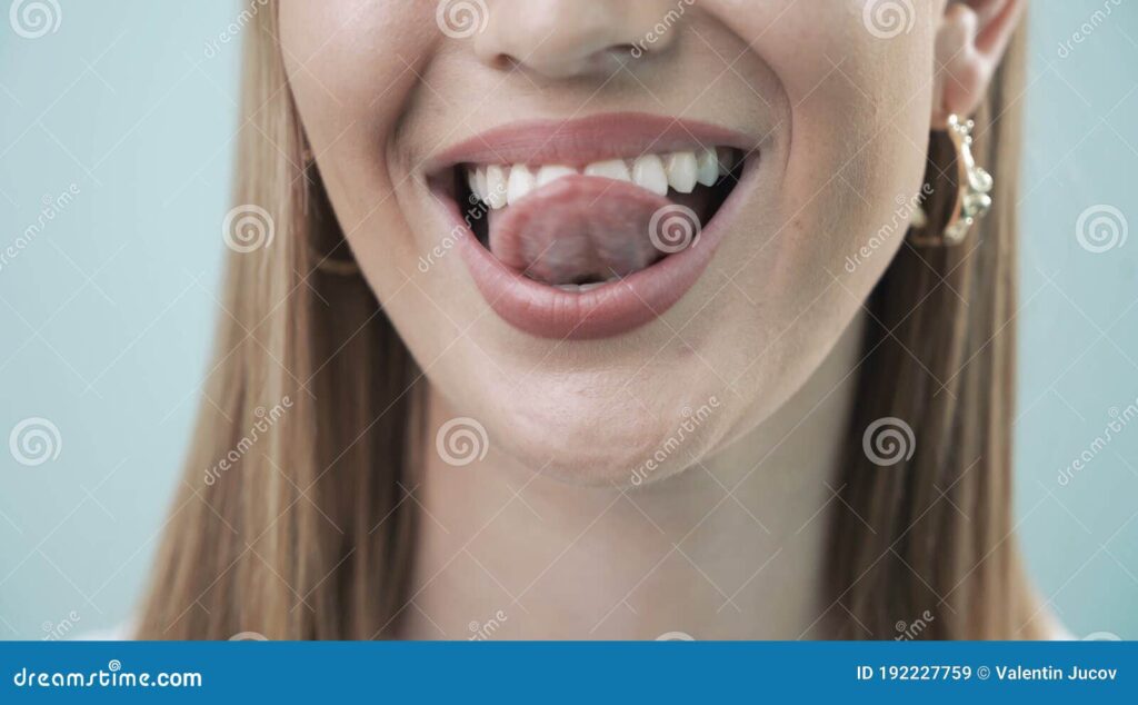 hospedagem e hotelzinho creche para PET Lylicas Dog Hotel lambendo sorrisos alegremente tratando dentes caninos